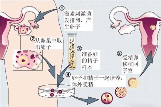 为什么供卵试管宝宝老是摇头